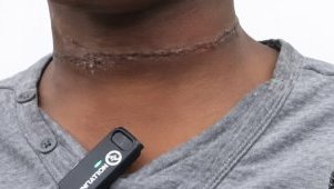 Violences sur mineur au PK18&nbsp;: une mère arrêtée, l’enfant pris en charge