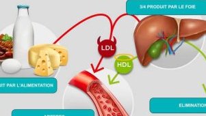 Cholestérol&nbsp;: un ennemi silencieux au cœur des maladies cardiovasculaires