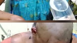 Insécurité à Libreville&nbsp;: une jeune femme victime d’une agression violente